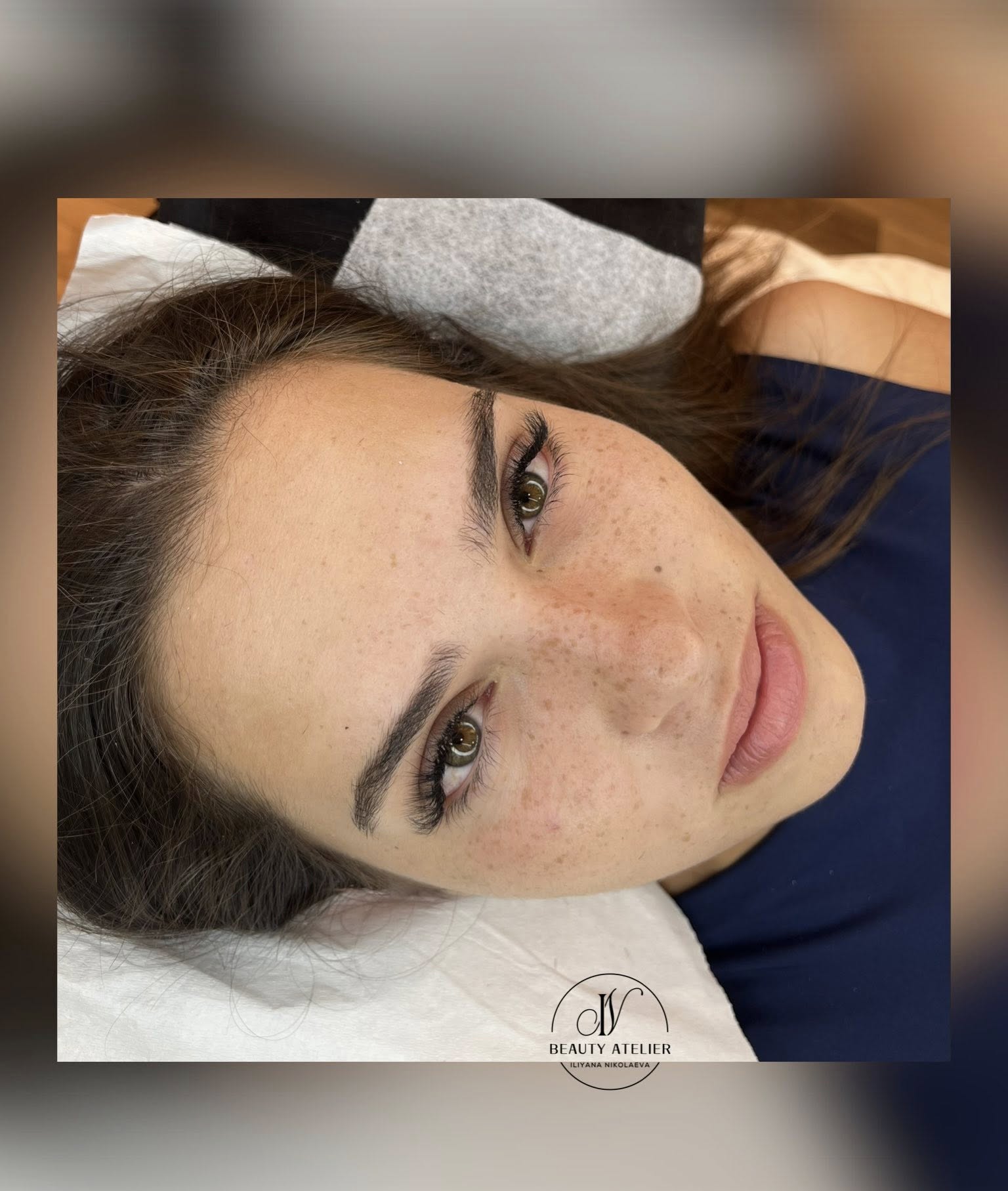 Миглопластика – Beauty Atelier IN