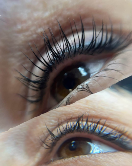 Миглопластика – Beauty Atelier IN