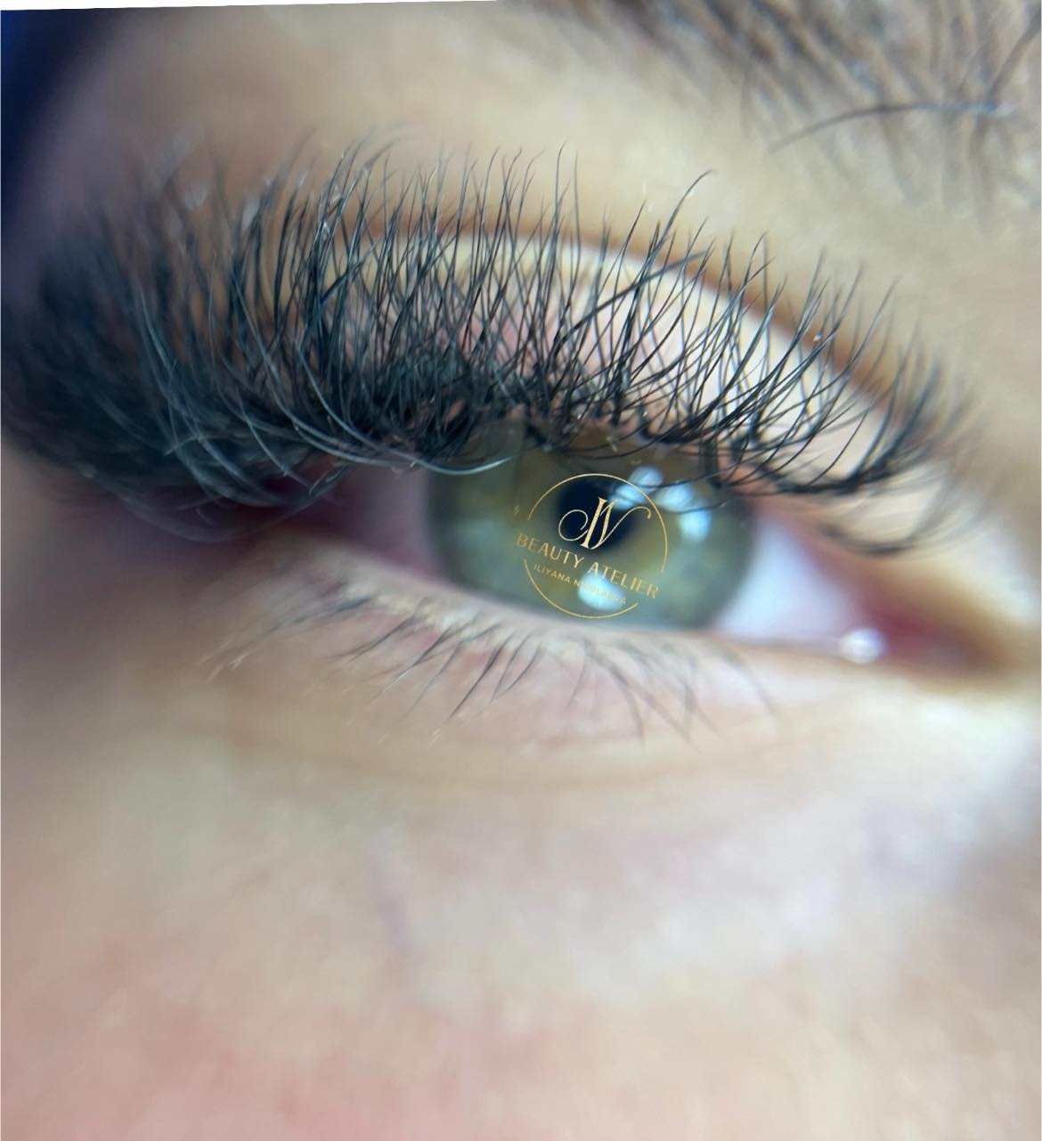 Миглопластика – Beauty Atelier IN