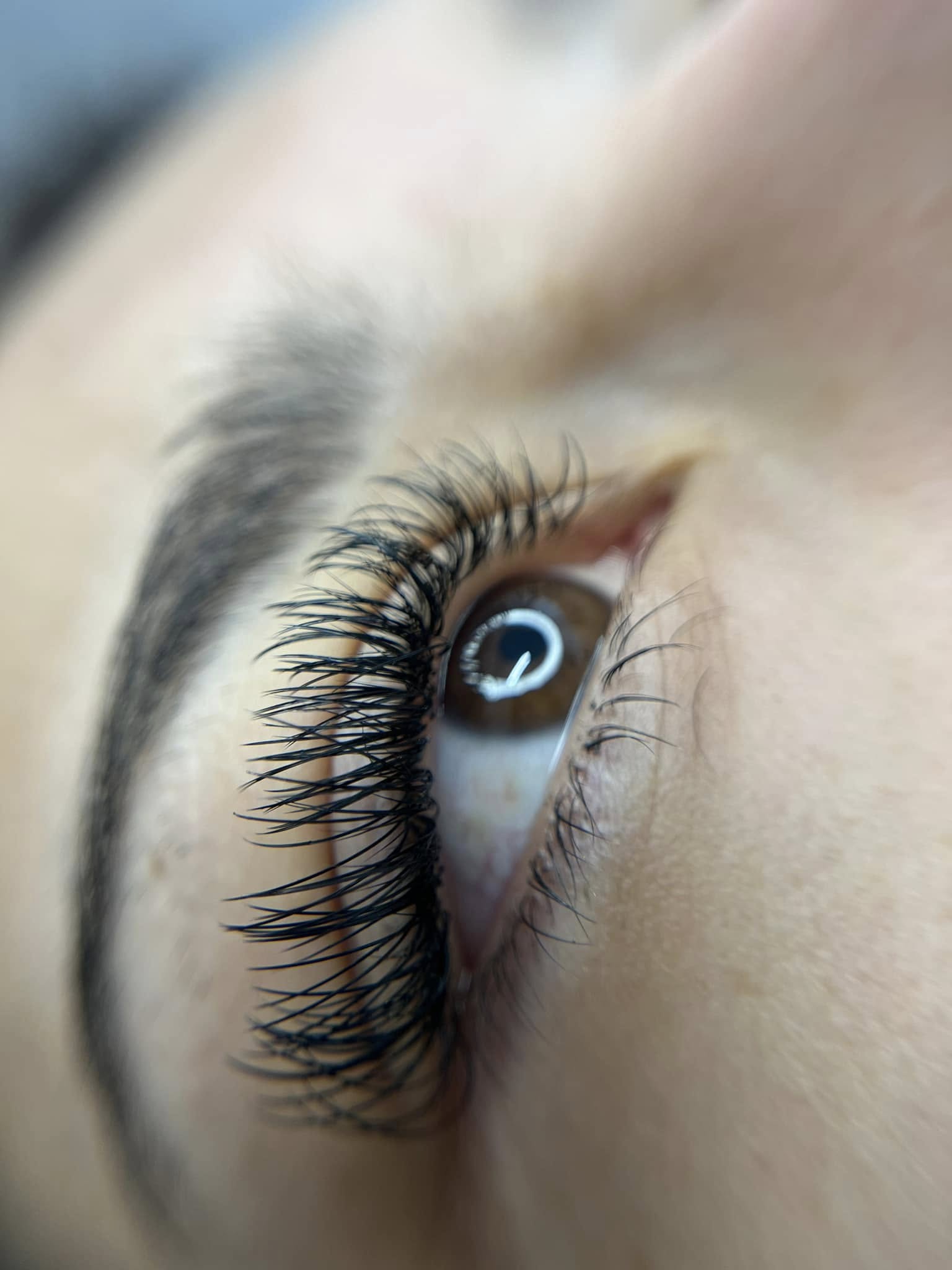 Миглопластика – Beauty Atelier IN