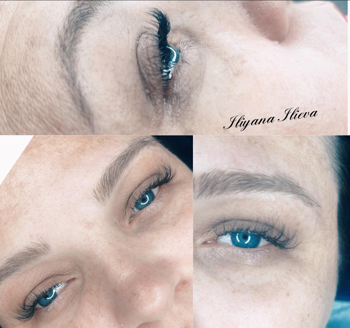 Миглопластика – Beauty Atelier IN