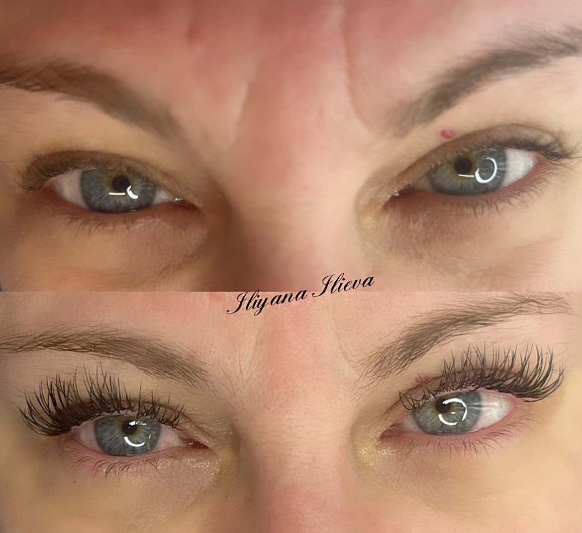 Миглопластика – Beauty Atelier IN