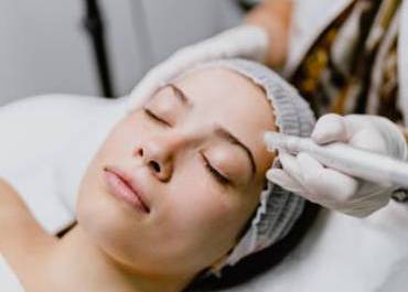 microneedling
