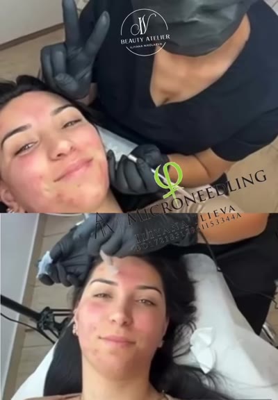 Видео – Beauty Atelier IN