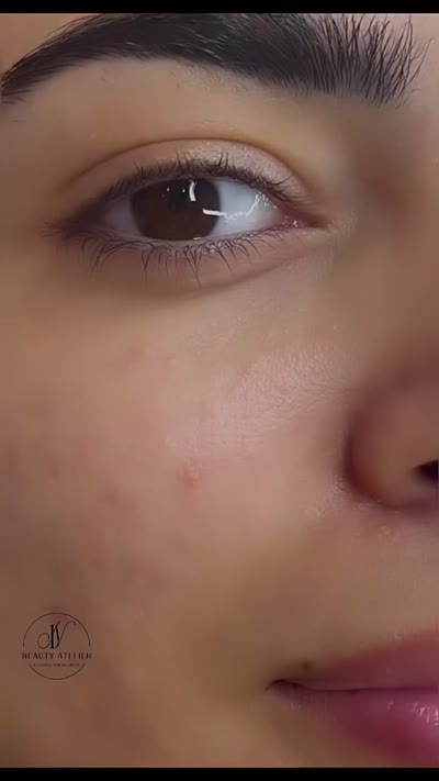 Видео – Beauty Atelier IN