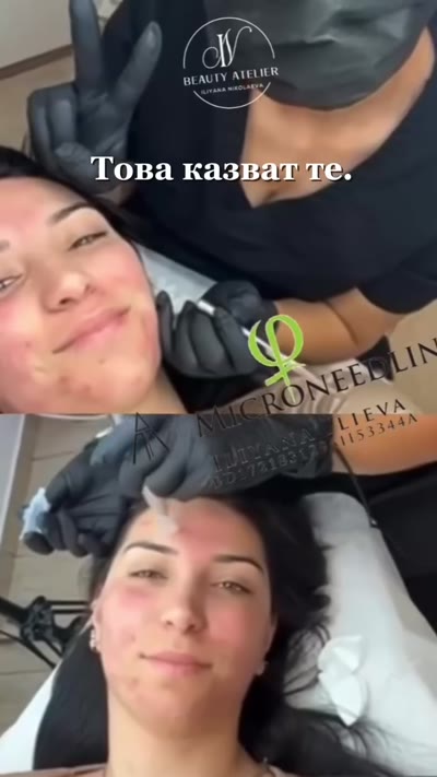 Видео – Beauty Atelier IN